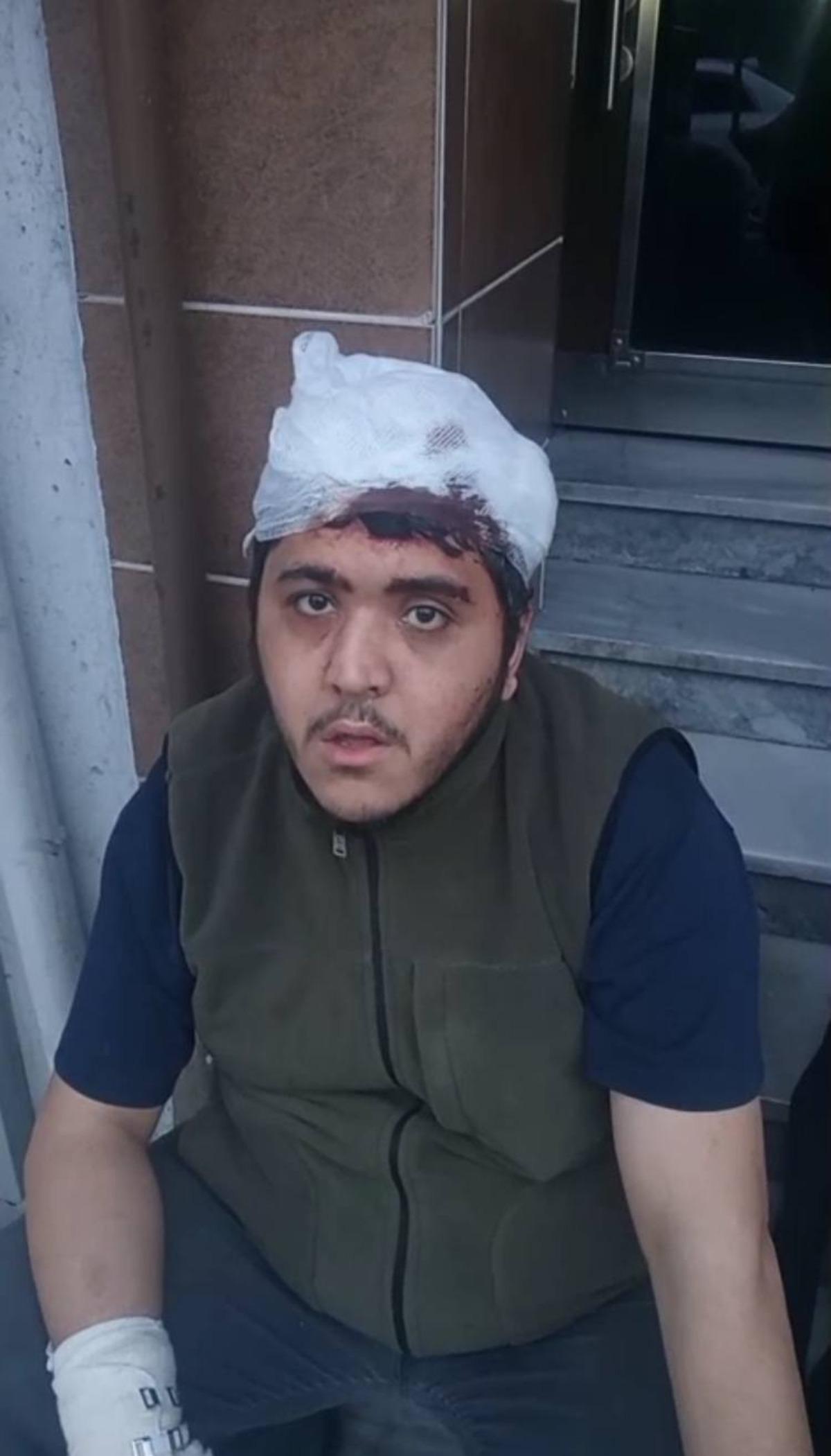 Sultangazi de zihinsel engelli ve annesine sopalı saldırı!  Beni istemiyorlar  3