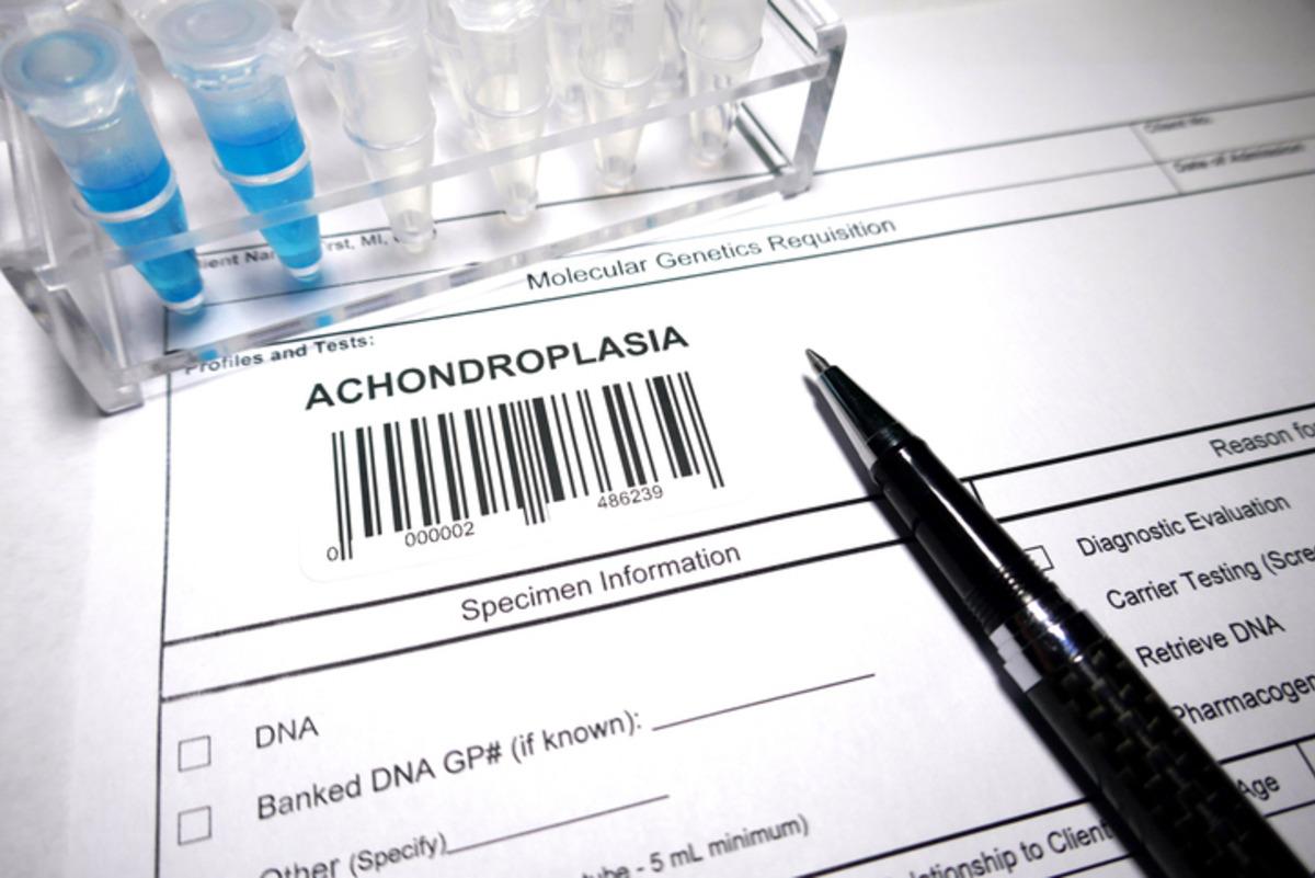 C&uuml;celik tedavisinde &ouml;nemli gelişme: "30 cm boy kazanımı m&uuml;mk&uuml;n" 1