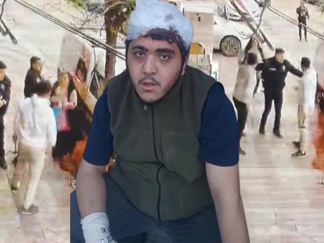 Sultangazi'de zihinsel engelli ve annesine sopalı saldırı! 'Beni istemiyorlar'