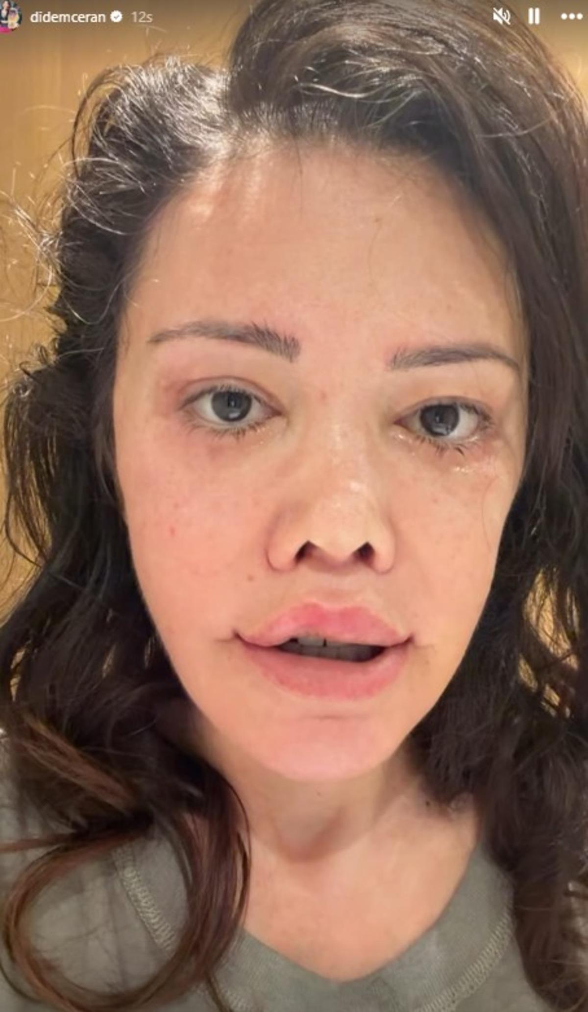 Eski Survivor yarışmacısı Didem Ceran y&uuml;z naklinden aylar sonra paylaştı! Yeni g&ouml;r&uuml;n&uuml;m&uuml;ne yorum yağdı  3