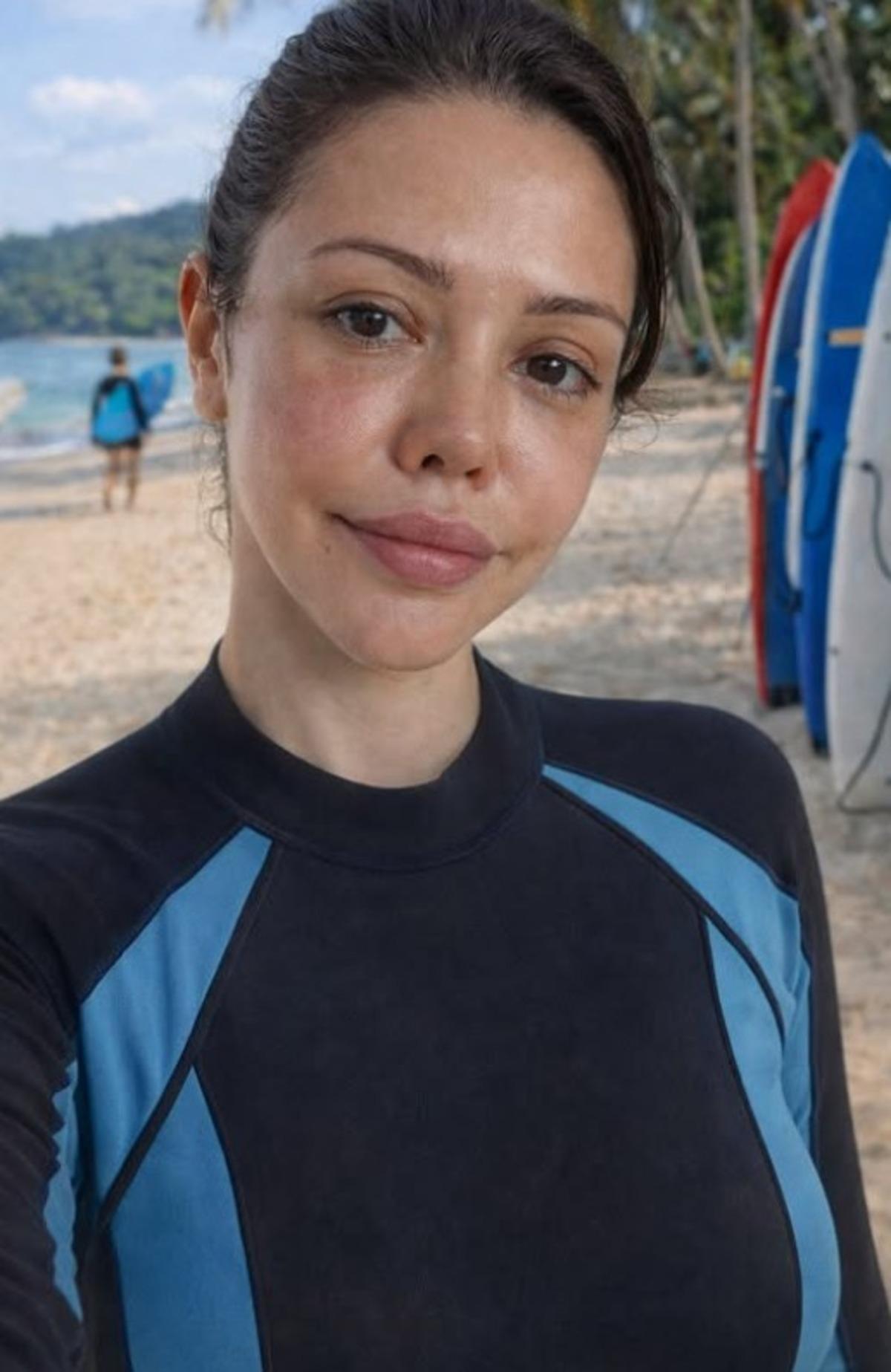 Eski Survivor yarışmacısı Didem Ceran y&uuml;z naklinden aylar sonra paylaştı! Yeni g&ouml;r&uuml;n&uuml;m&uuml;ne yorum yağdı  2