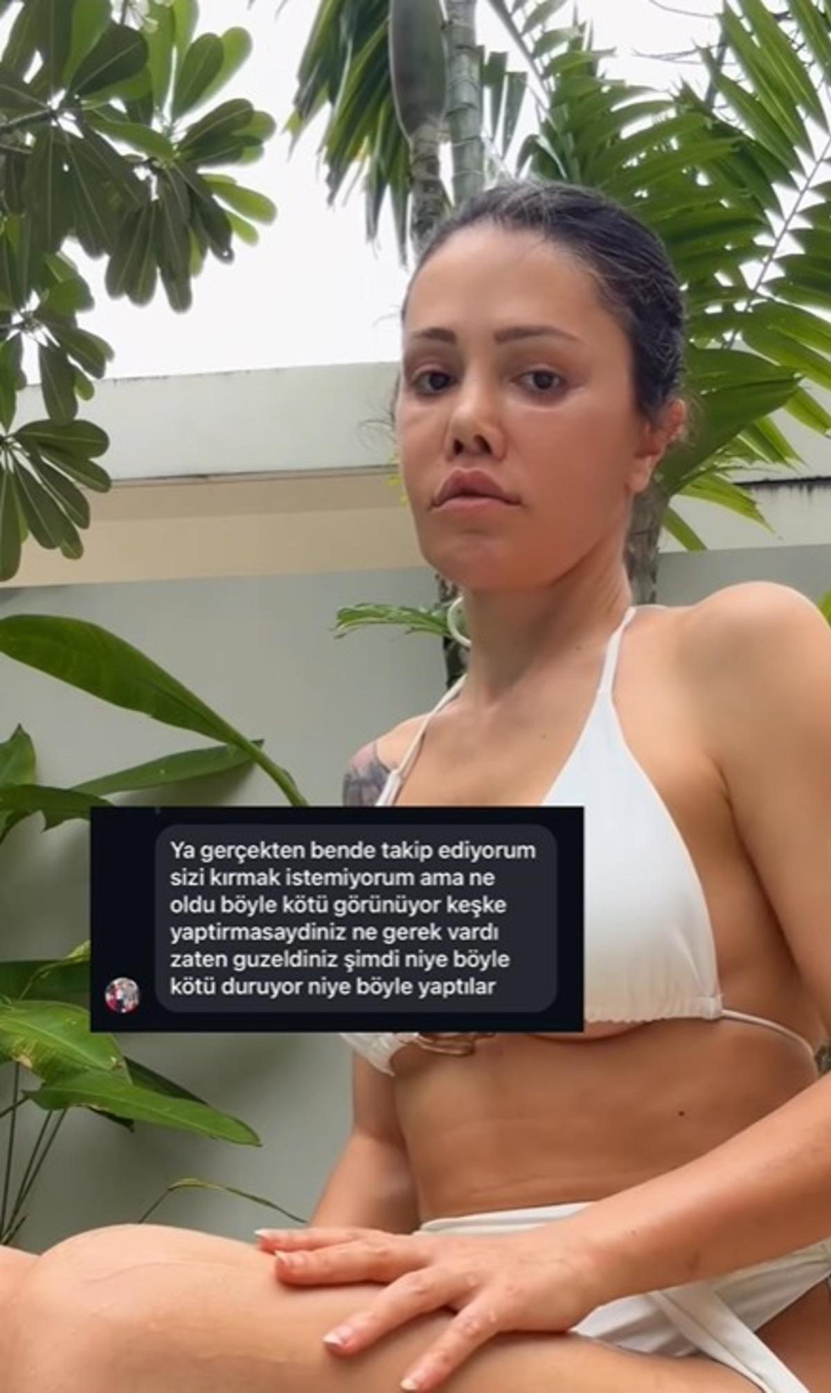 Eski Survivor yarışmacısı Didem Ceran y&uuml;z naklinden aylar sonra paylaştı! Yeni g&ouml;r&uuml;n&uuml;m&uuml;ne yorum yağdı  4