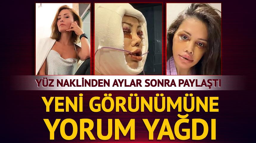 Y&uuml;z naklinden aylar sonra paylaştı! Yorum yağdı 