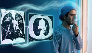 D&uuml;nyada en &ccedil;ok &ouml;ld&uuml;ren 4. hastalık: "Akciğeri par&ccedil;alıyor"