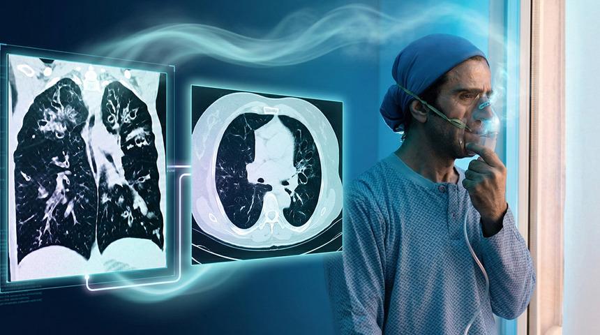 D&uuml;nyada en &ccedil;ok &ouml;ld&uuml;ren 4. hastalık: "Akciğeri par&ccedil;alıyor"