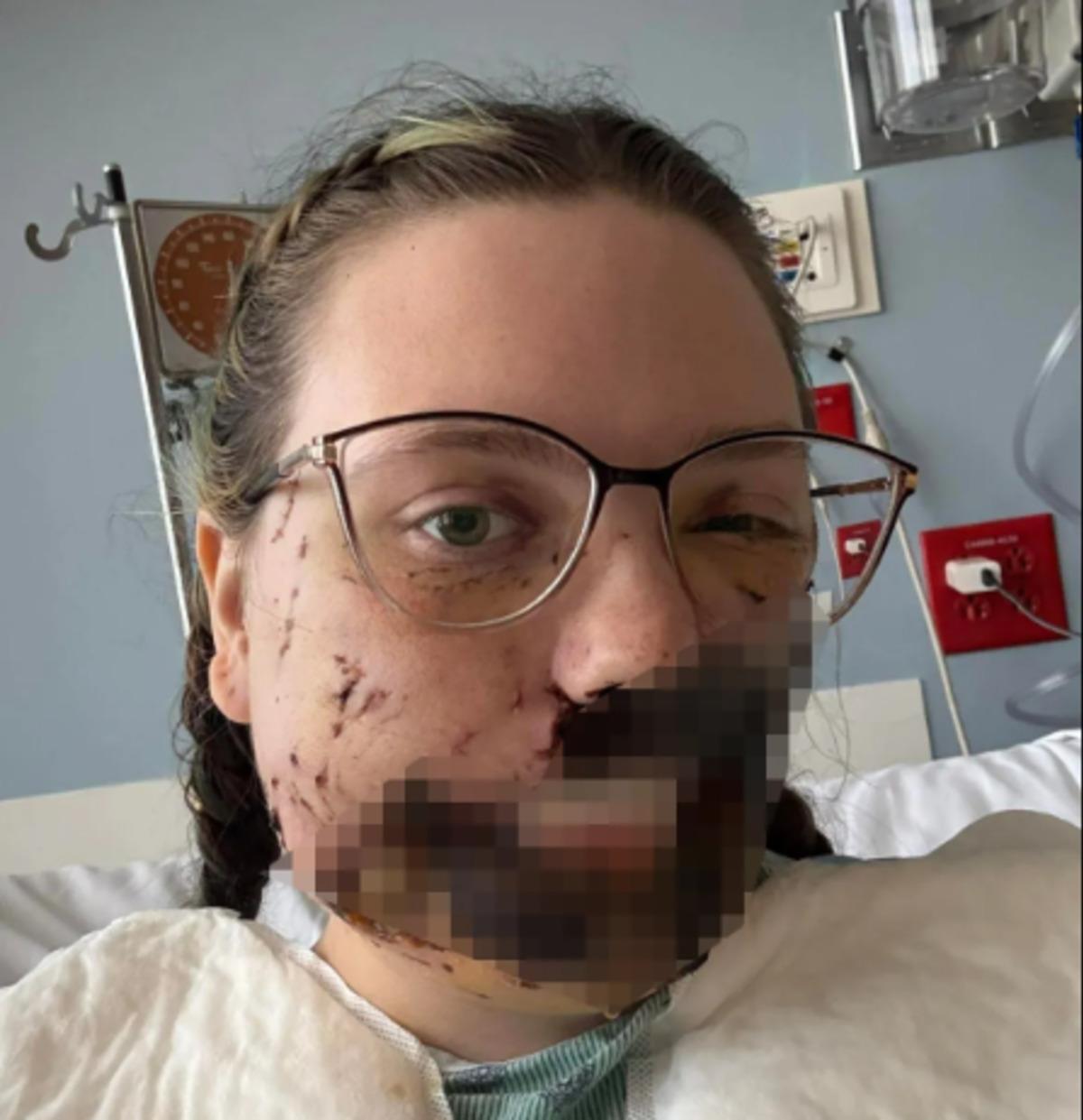 N&ouml;bet ge&ccedil;irirken k&ouml;peği y&uuml;z&uuml;n&uuml; par&ccedil;aladı! 1