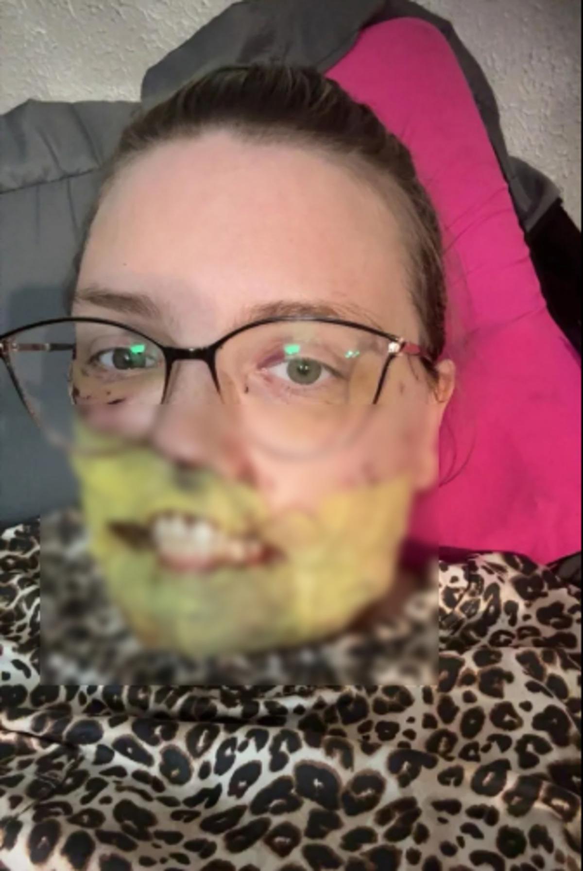 N&ouml;bet ge&ccedil;irirken k&ouml;peği y&uuml;z&uuml;n&uuml; par&ccedil;aladı! 4