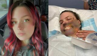 N&ouml;bet ge&ccedil;irirken k&ouml;peği y&uuml;z&uuml;n&uuml; par&ccedil;aladı!