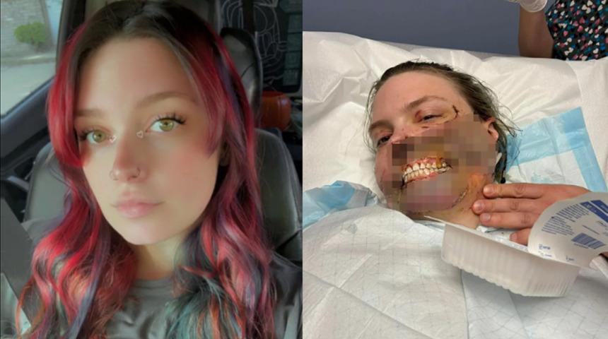 N&ouml;bet ge&ccedil;irirken k&ouml;peği y&uuml;z&uuml;n&uuml; par&ccedil;aladı!