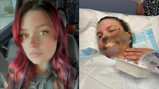 Nöbet geçirirken köpeği yüzünü parçaladı!