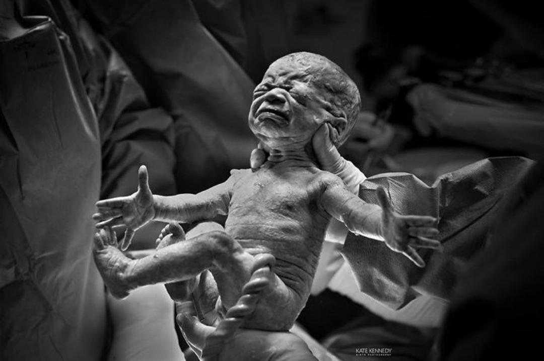 2018 Doğum Fotoğrafları Yarışması&rsquo;nın en iyileri 