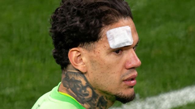 Fenerbahçe'den Ederson'a yapılan saldırı sonrası sert mesaj