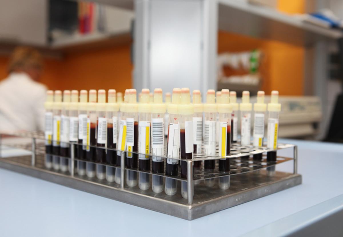 Kan grubunuz hangi hastalıklara yatkın olduğunuzu söylüyor 4