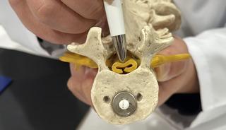 Bel fıtığıyla aynı belirtileri olan sinsi hastalık