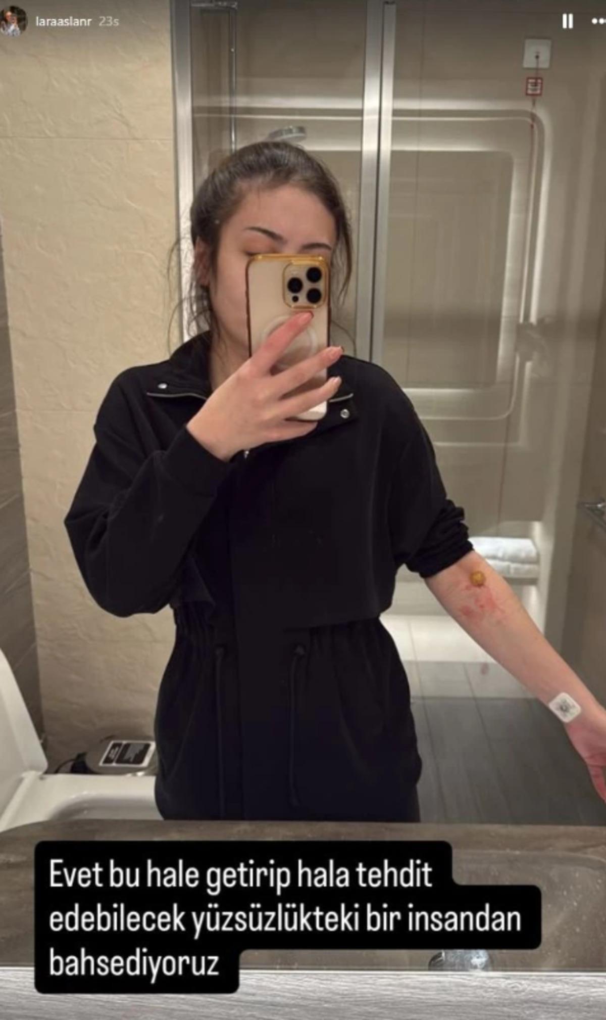 Lara Aslan dan Sabri Sarıoğlu hakkında olay iddialar: "Bana hastalık bulaştırdı" 3