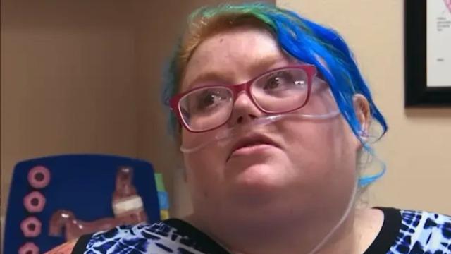 269 kiloya kadar çıkmıştı: Yaşam mücadelesini kaybetti!