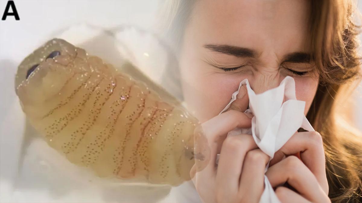 Hapşırınca solucan çıkardı! 'İmkansız' denen vaka