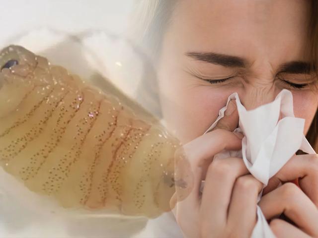 Hapşırınca solucan &ccedil;ıkardı! 'İmkansız' denen vaka