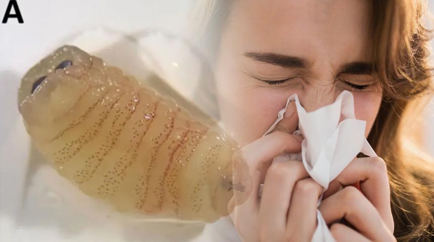 Hapşırınca solucan &ccedil;ıkardı! 'İmkansız' denen vaka