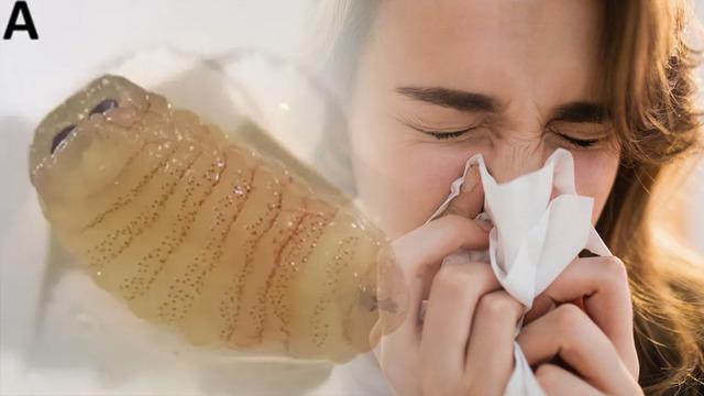 Hapşırınca solucan çıkardı! 'İmkansız' denen vaka