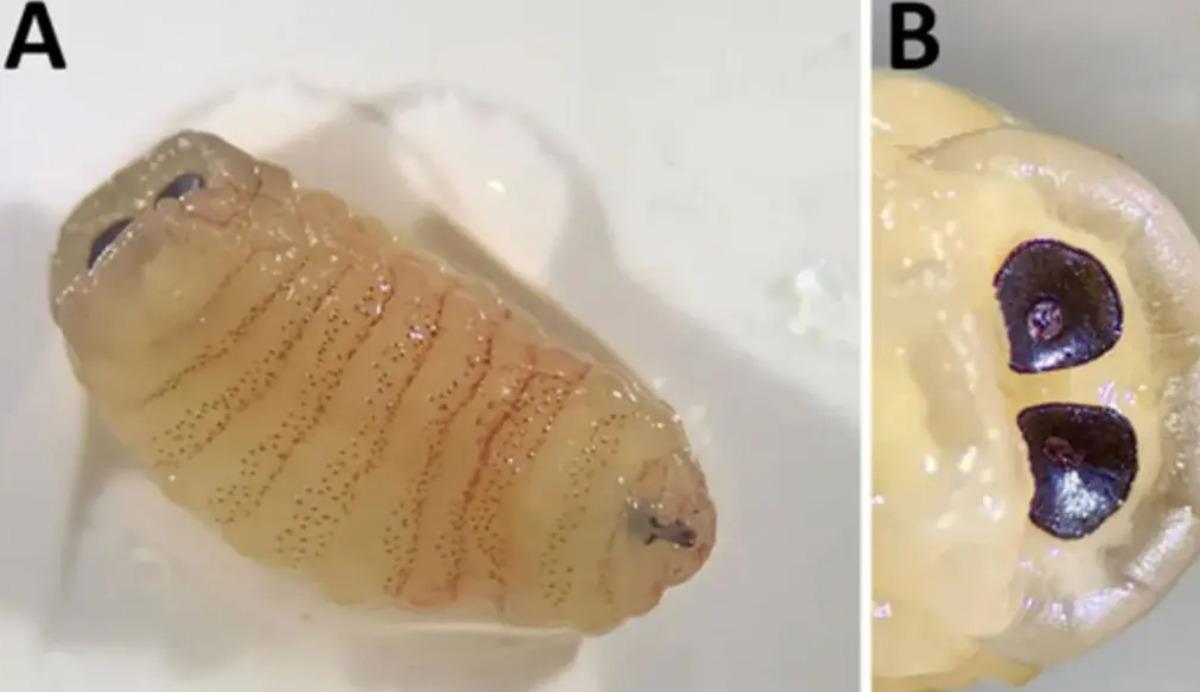 Hapşırınca solucan &ccedil;ıkardı!  İmkansız  denen vaka 1