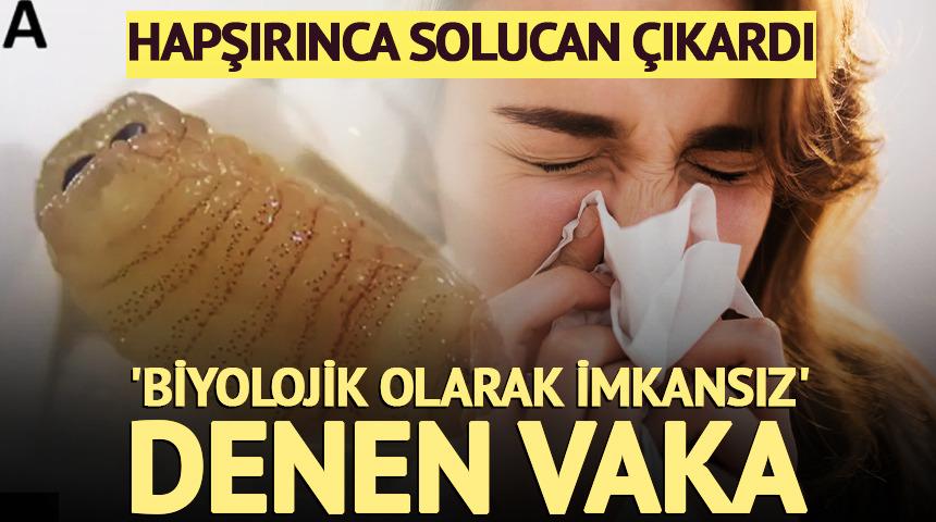 Hapşırınca solucan &ccedil;ıkardı! 'İmkansız' denen vaka