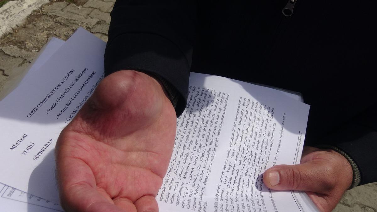 "İyiye gidiyor" dediler, parmağı çürüdü: Kolunda metal parça unutuldu! İhmaller zinciri hayatını kabusa çevirdi 3