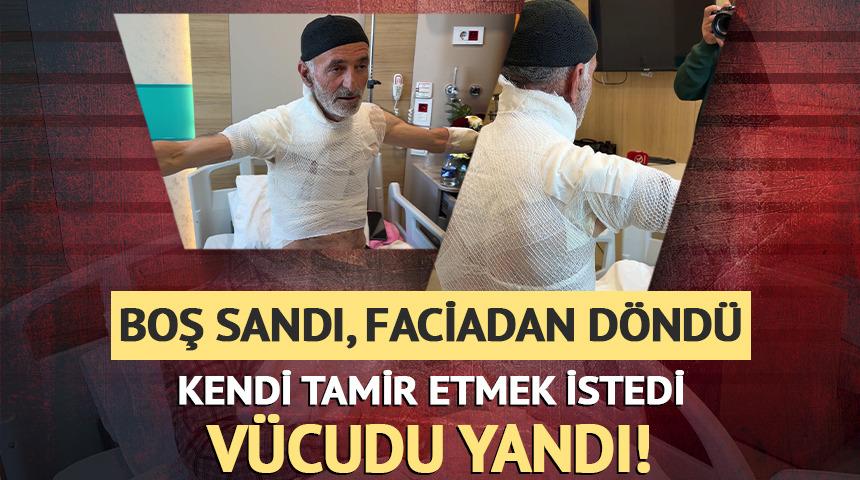 Kendi tamir etmek istedi: V&uuml;cudu yandı!