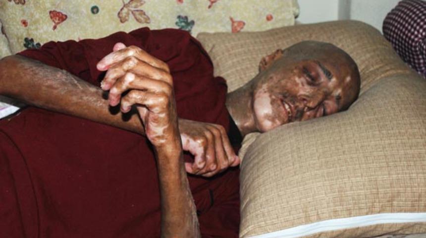 Elazığ'da 2 yıl önce lösemi hastalığına yakalanan vatandaş yardım bekliyor