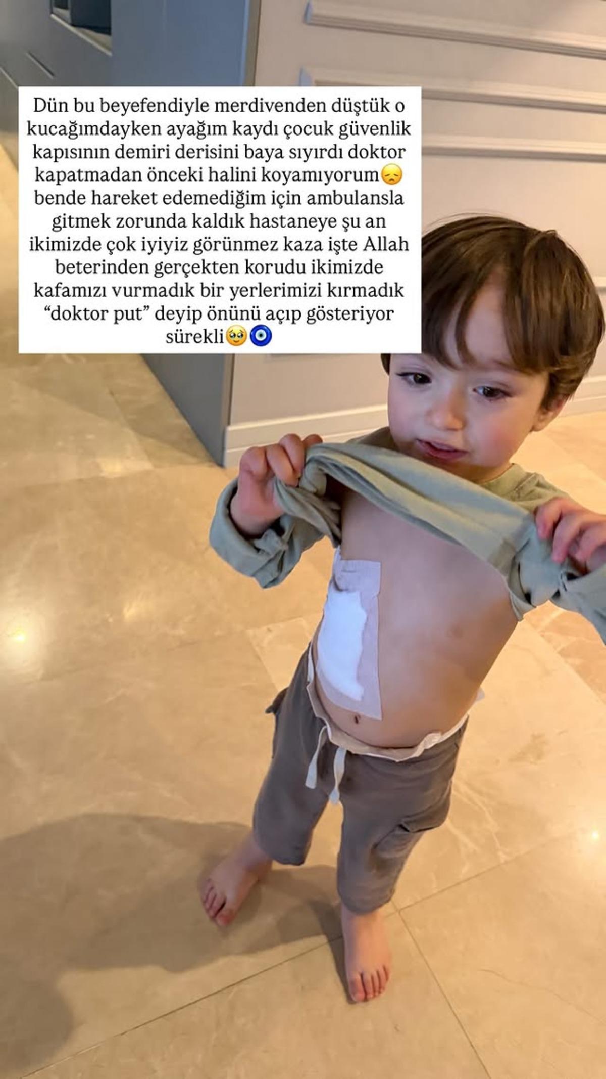 Yasemin Şefkatli ve oğlu merdivenden düştü! Apar topar hastaneye kaldırıldı 2