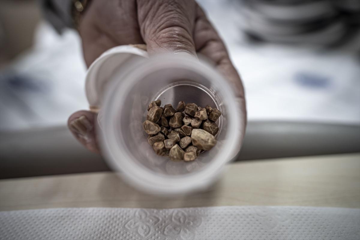 2 &ccedil;ocuk annesi kadının v&uuml;cudundan &ccedil;ıkarıldı! Tam 51 tane... "İlk kez g&ouml;rd&uuml;m" 1