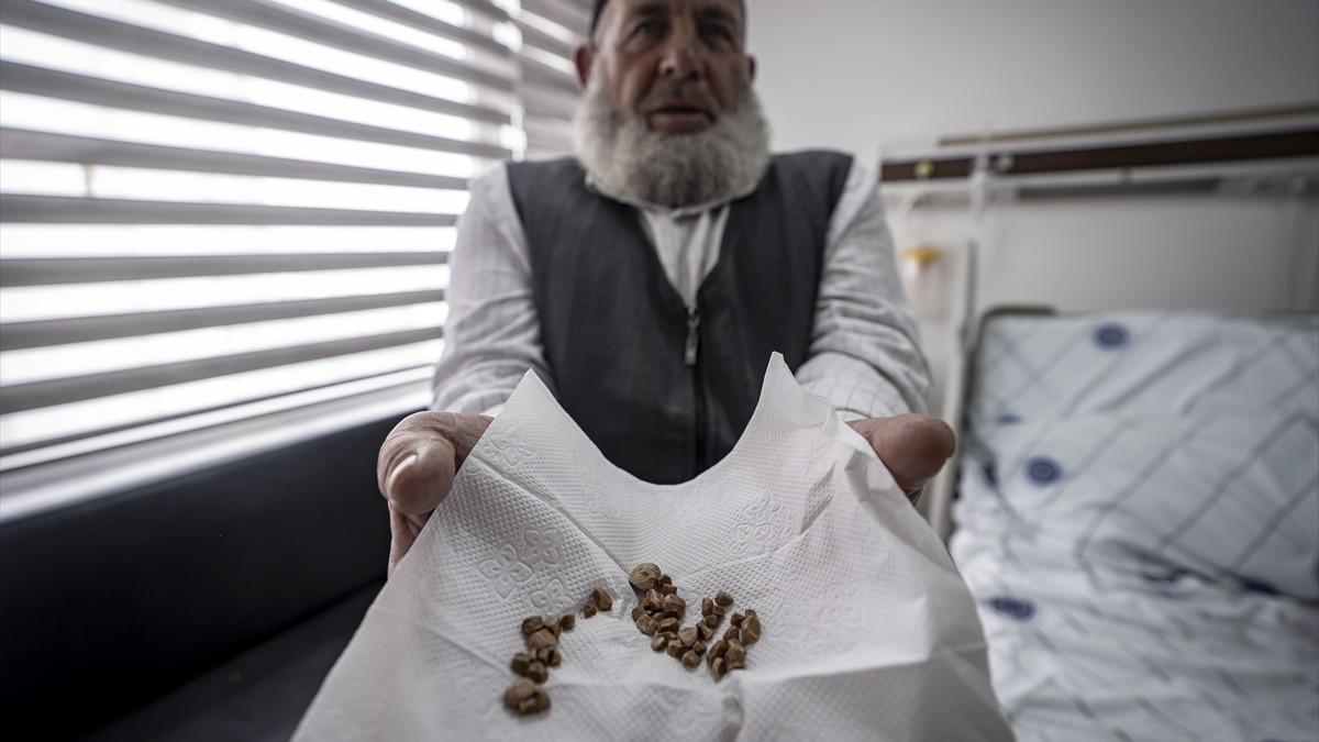 2 çocuk annesi kadının vücudundan çıkarıldı! Tam 51 tane... "İlk kez gördüm"