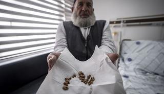 2 &ccedil;ocuk annesi kadının v&uuml;cudundan &ccedil;ıkarılanlar doktoru da şaşırttı!