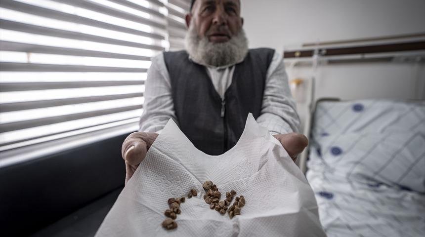 2 &ccedil;ocuk annesi kadının v&uuml;cudundan &ccedil;ıkarıldı! Tam 51 tane... "İlk kez g&ouml;rd&uuml;m"