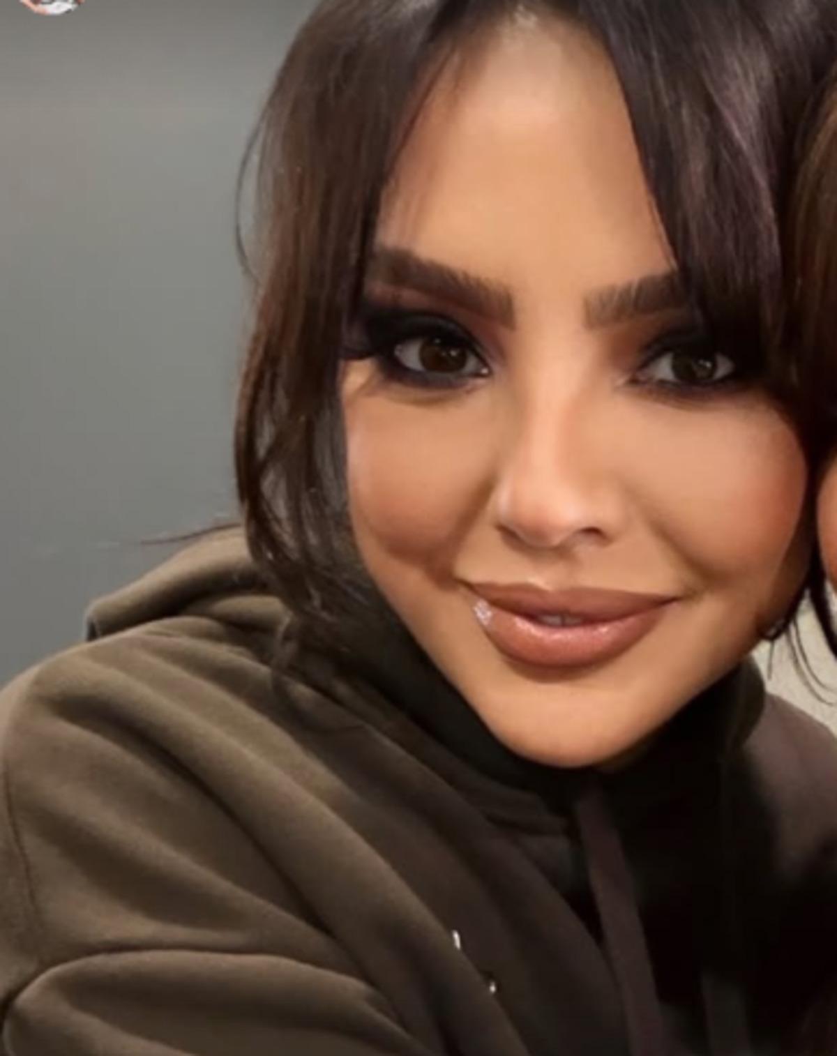 Ebru G&uuml;ndeş ten estetik itirafı! Son hali g&uuml;ndemde 4