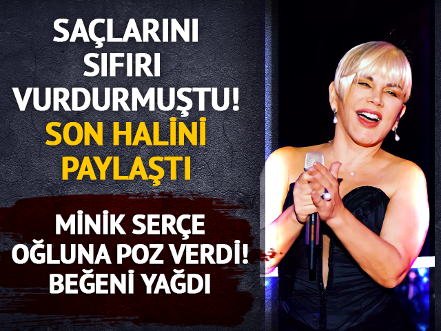 Sa&ccedil;larını sıfıra vurdurmuştu! Son halini paylaştı