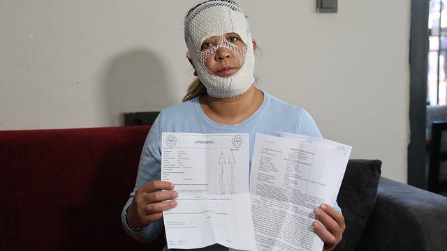 Adı 'Prenses' sonucu kabus: Oğlu bile öcü sandı! 7 bin liralık yanık