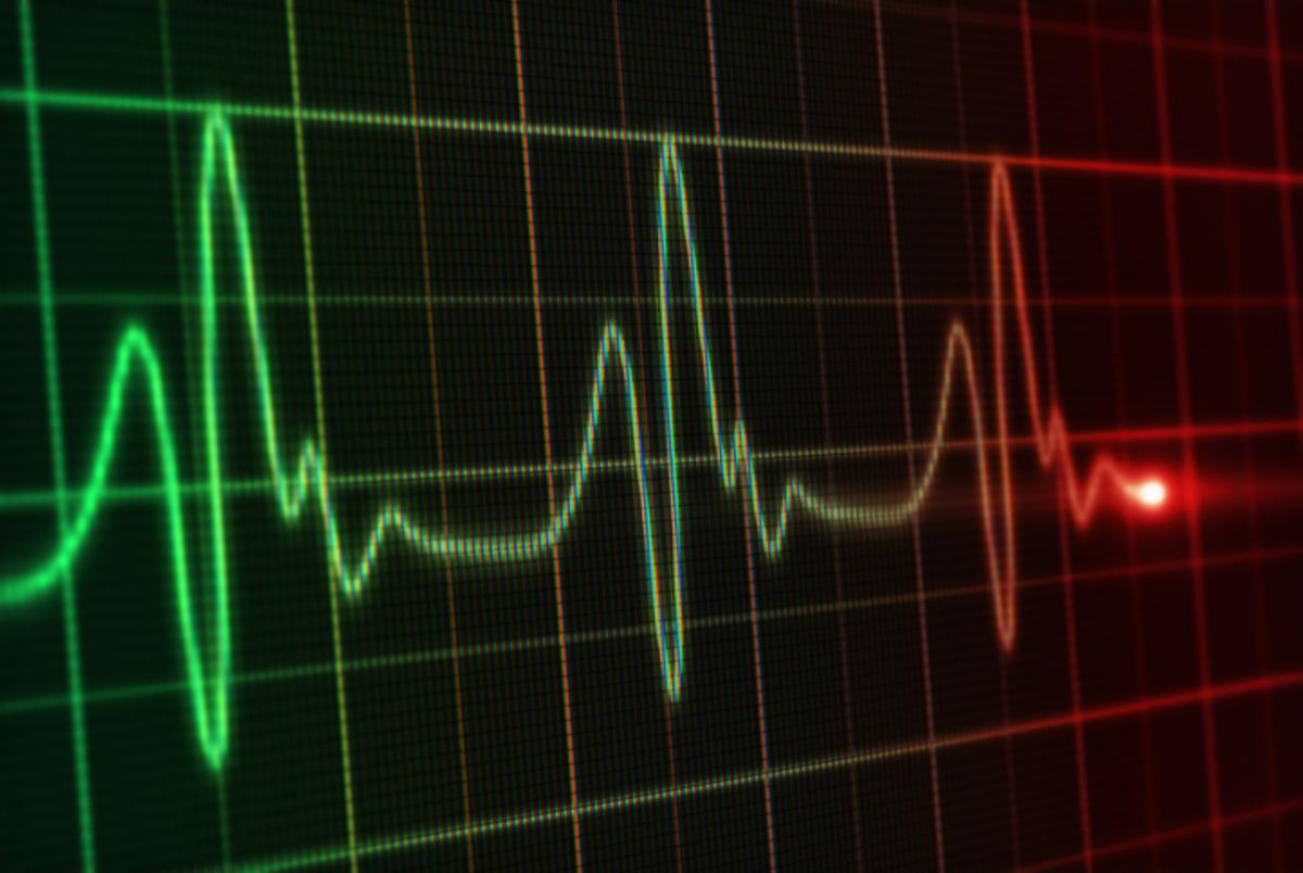 35 yaşa kadar d&uuml;şt&uuml;! Bu alışkanlık kalp krizini tetikliyor 3