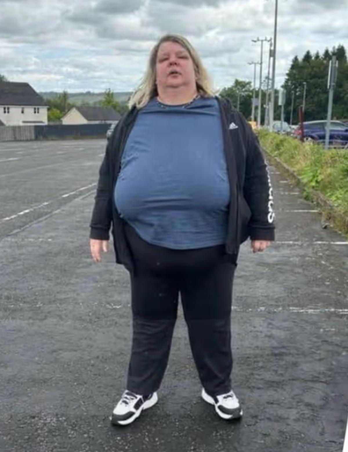 Ne iğne, ne ila&ccedil;! V&uuml;cudunun yarısı eriyip gitti 2