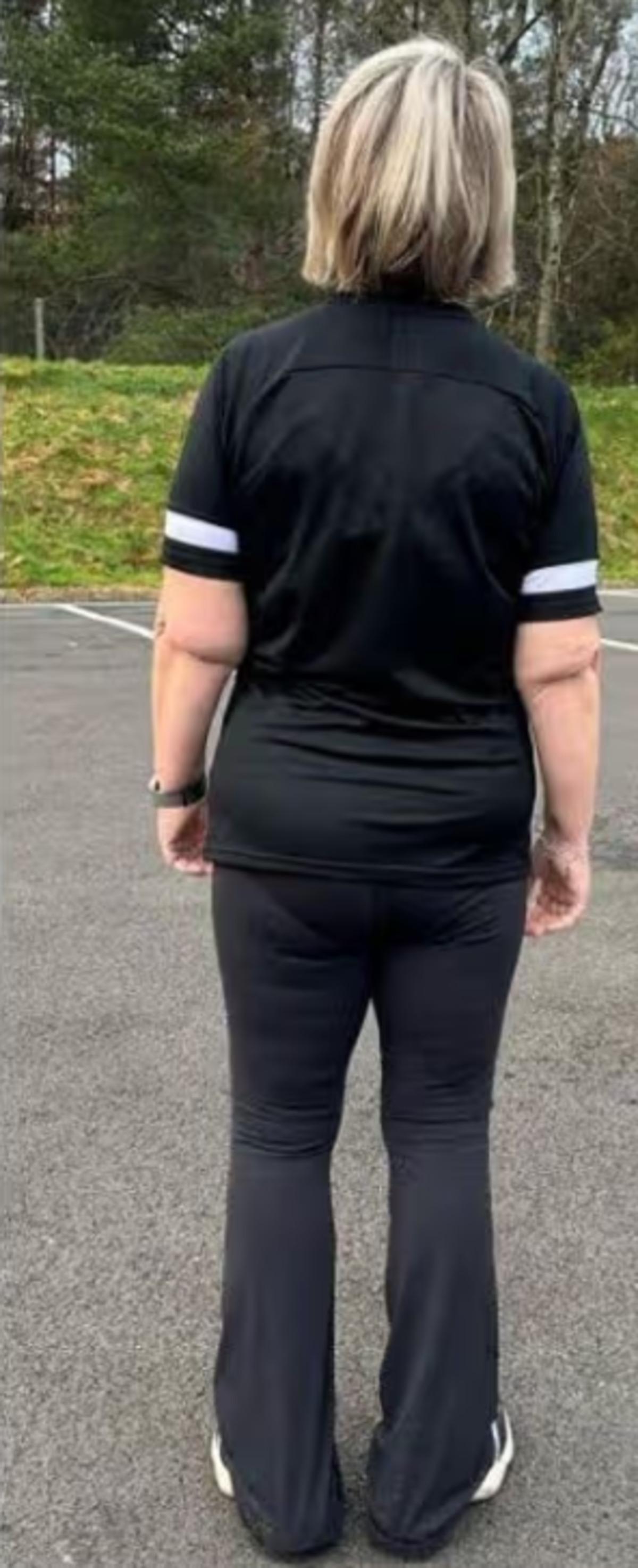 Ne iğne, ne ila&ccedil;! V&uuml;cudunun yarısı eriyip gitti 3