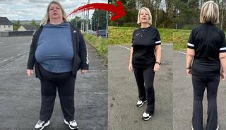 Ne iğne, ne ila&ccedil;! V&uuml;cudunun yarısı eriyip gitti