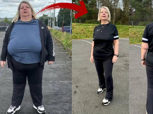 Ne iğne, ne ila&ccedil;! V&uuml;cudunun yarısı eriyip gitti