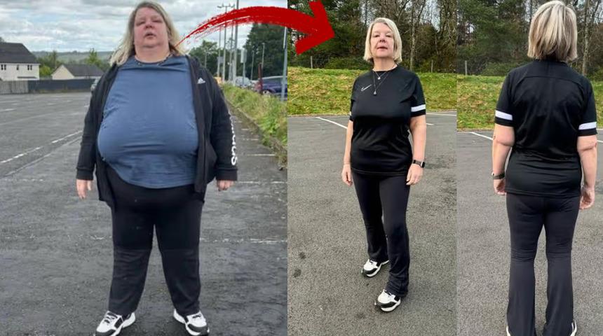 Ne iğne, ne ila&ccedil;! V&uuml;cudunun yarısı eriyip gitti