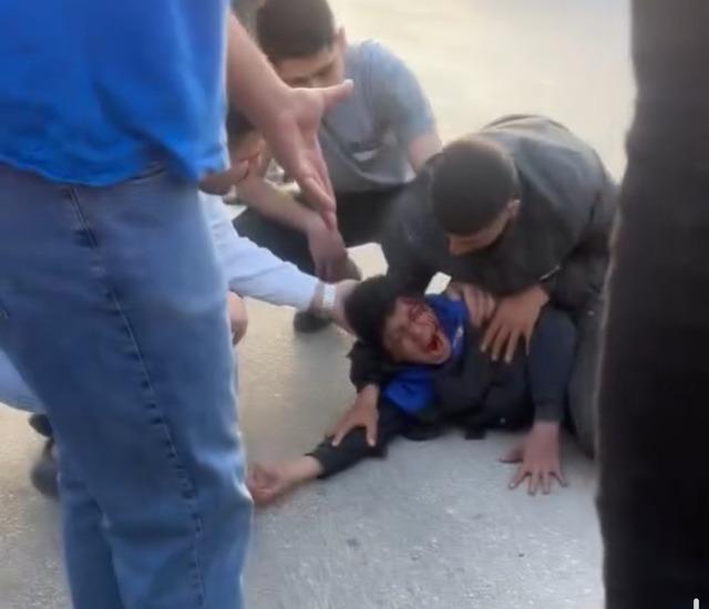 Otomobil &ccedil;arptı, elektrikli bisiklet ikiye b&ouml;l&uuml;nd&uuml;: S&uuml;r&uuml;c&uuml; havada takla attı 6