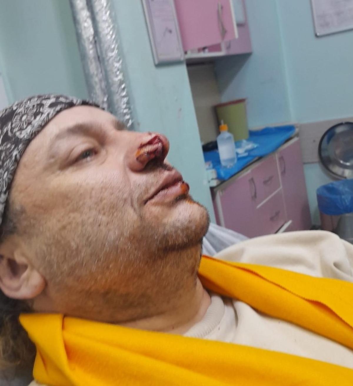 Et yiyen bakteriyle savaşıyor! Onur Akay ent&uuml;be edildi 2