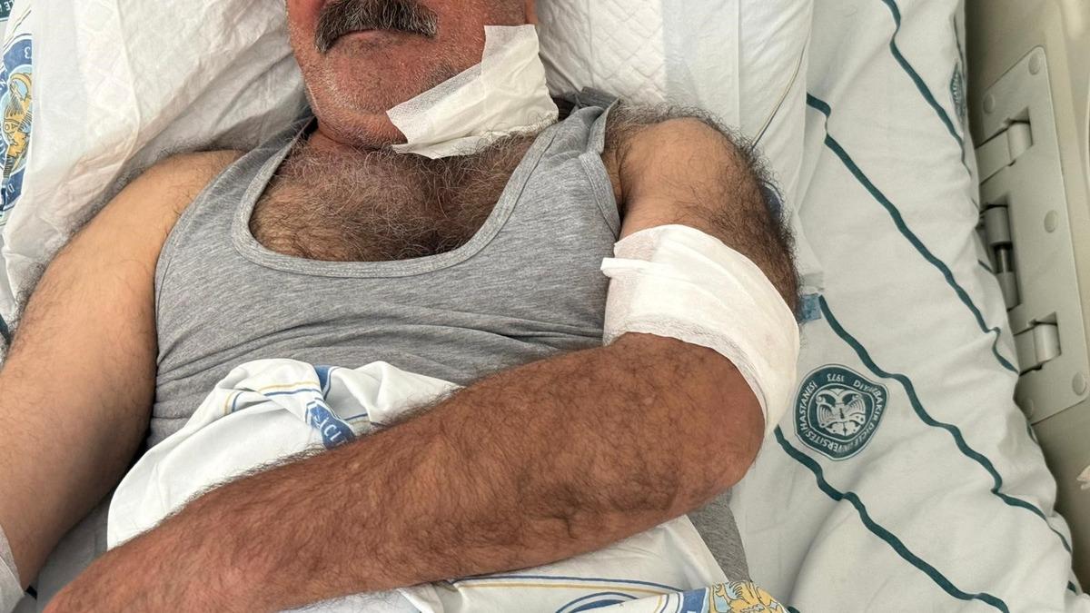 Diyarbakır da akılalmaz olay! Boğazını at ısırdı 1