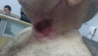 Diyarbakır'da akılalmaz olay! Boğazını at ısırdı