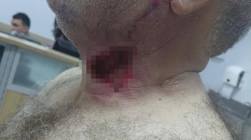 Diyarbakır'da akılalmaz olay! Boğazını at ısırdı