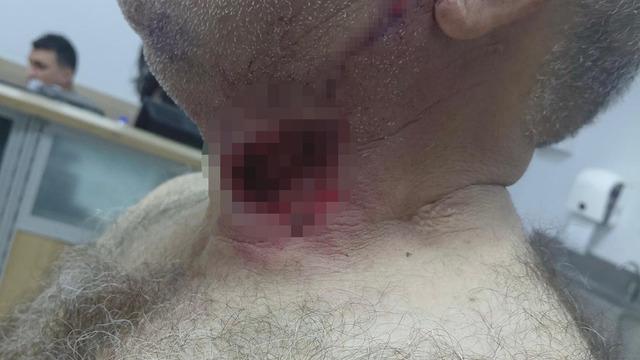 Diyarbakır'da akılalmaz olay! Boğazını at ısırdı