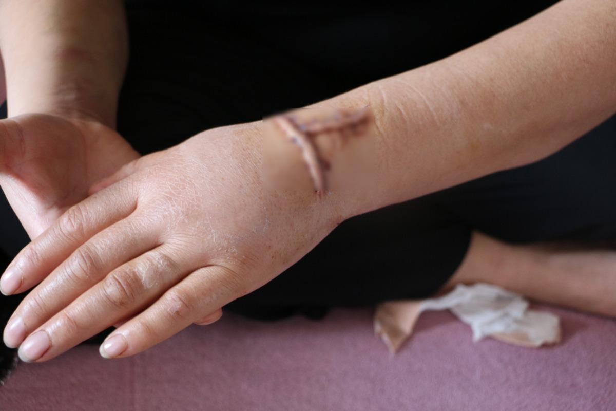 Pusu kurdu, 30 yerinden bı&ccedil;akladı! Eski eş dehşeti 1